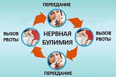 Лечение булимии в Гае